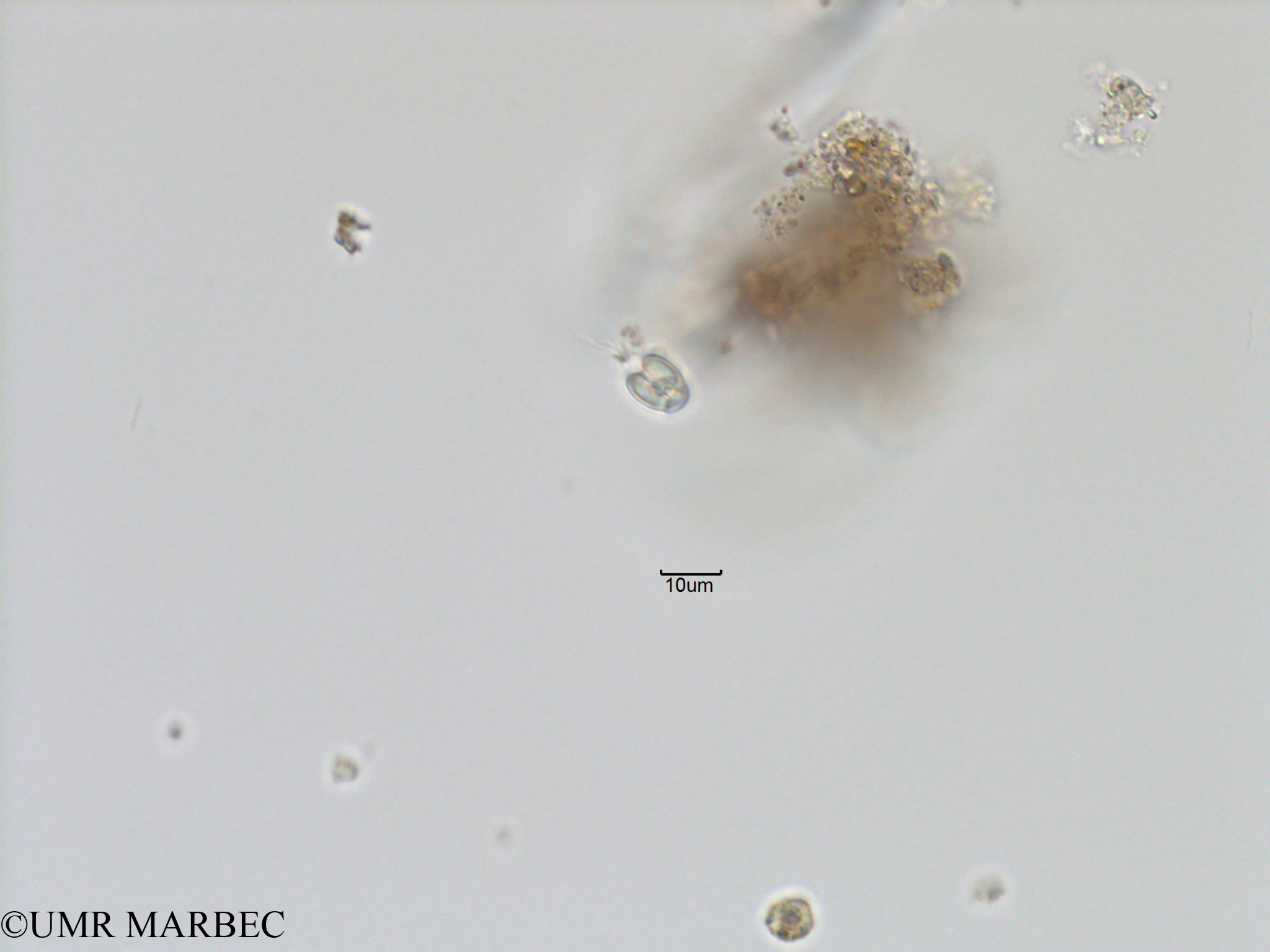 phyto/Bizerte/bizerte_bay/RISCO November 2015/Nanoflagellé 17 (Baie_T5-C1-Flagellé-4).tif(copy).jpg